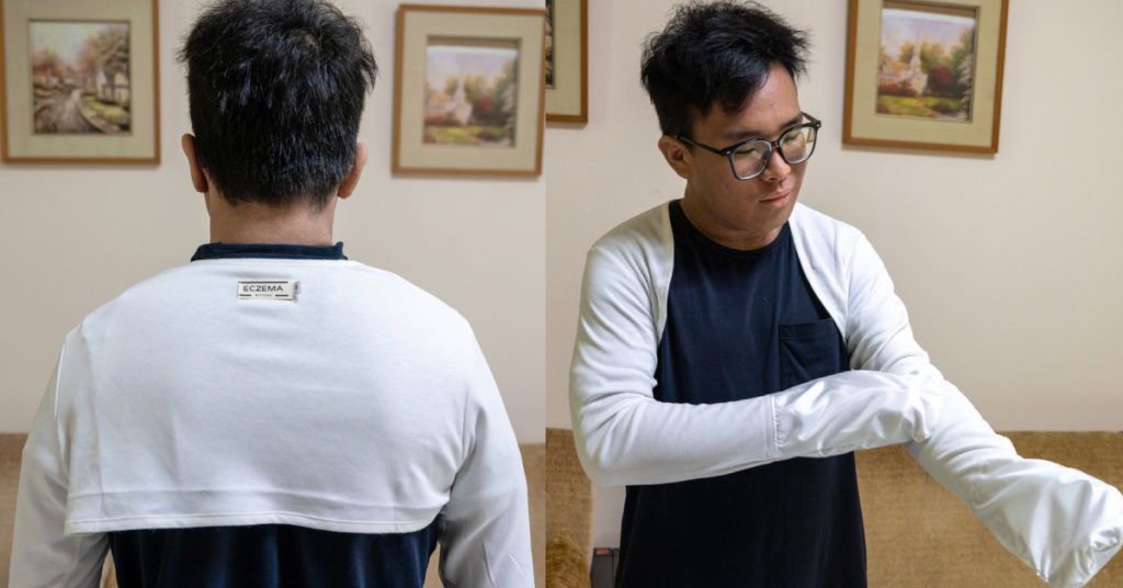 Nothing helped his eczema, so this S’porean invented his own fix