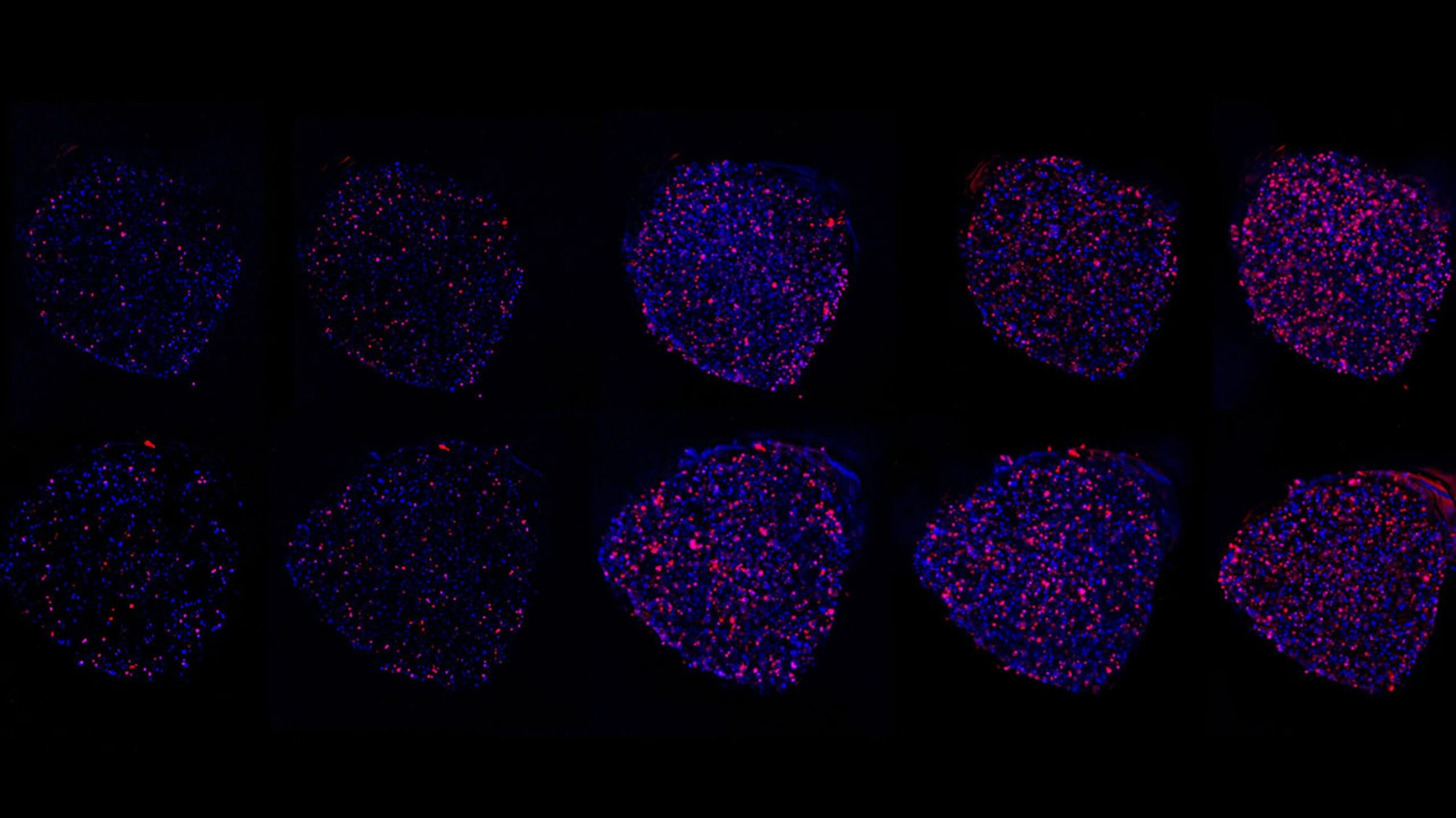 Scientists are growing tumors in space to study how to personalize cancer treatment