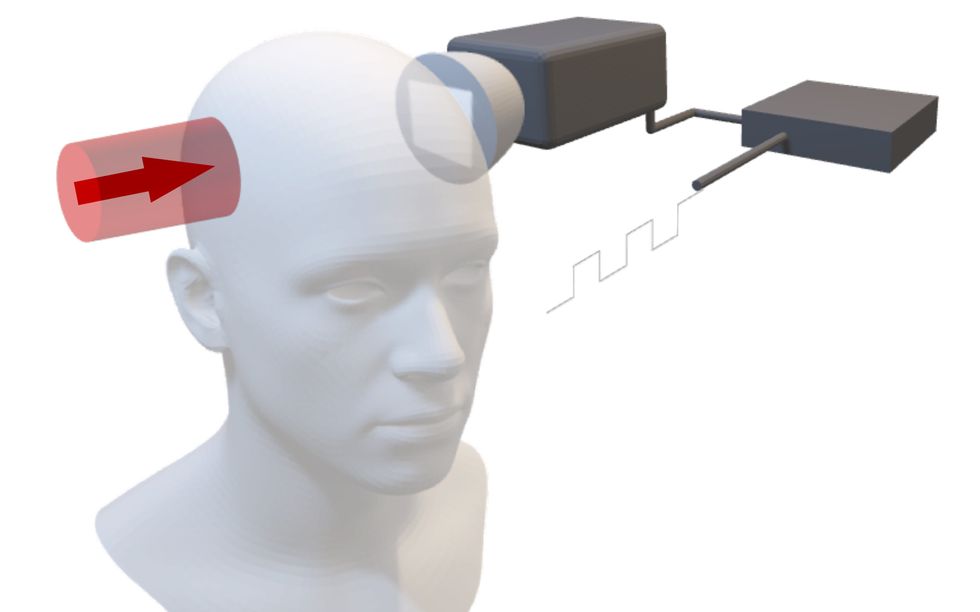Affordable Optical Brain Imaging Advances